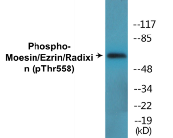 Western blot analysis of extracts from NIH-3T3 cells, using Moesin/Ezrin/Radixin (Phospho-Thr558) Antibody.