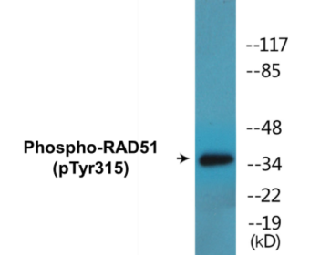 Western blot analysis of extracts from Jurkat cells, using RAD51 (Phospho-Tyr315) Antibody.