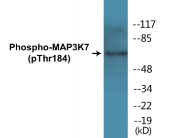 Western blot analysis of extracts from HepG2 cells treated with TNF 20ng/ml 5', using TAK1 (Phospho-Thr184) Antibody.