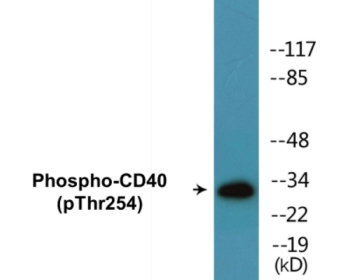 Western blot analysis of extracts from COLO205 cells treated with Insulin 0.01U/ml 15', using TNFRSF5 (Phospho-Thr254) Antibody.