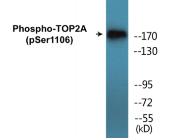 Western blot analysis of extracts from Jurkat cells treated with paclitaxel 1uM 24h, using TOP2A (Phospho-Ser1106) Antibody.