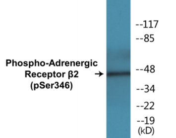 Western blot analysis of extracts from HepG2 cells treated with nocodazole 1ug/ml 16h, using Adrenergic Receptor beta2 (Phospho-Ser346) Antibody.