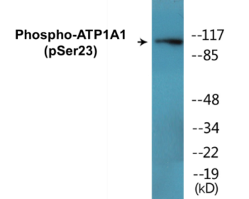 Western blot analysis of extracts from rat brain, using ATP1 alpha1/Na+K+ ATPase1 (Phospho-Ser23) Antibody.