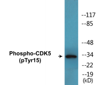 Western blot analysis of extracts from COS7 cells treated with EGF 200ng/ml 30' and 293 cells treated with H2O2 100u, 15mins, using CDK5 (Phospho-Tyr15) Antibody.