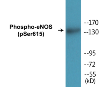 Western blot analysis of extracts from K562 cells treated with EGF 40nM 30', using eNOS (Phospho-Ser615) Antibody.