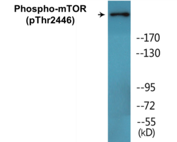Western blot analysis of extracts from NIH-3T3 cells treated with Insulin 0.01U/ml 15', using mTOR (Phospho-Thr2446) Antibody.