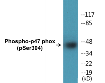Western blot analysis of extracts from COS7 cells treated with UV 15' and A549 cells, using Neutrophil Cytosol Factor 1 (Phospho-Ser304) Antibody.