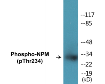 Western blot analysis of extracts from HeLa cells treated with nocodazole 1ug/ml 18h, using NPM (Phospho-Thr234) Antibody.