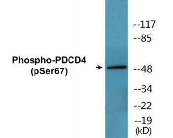 Western blot analysis of extracts from HuvEc cells, K562 cells and COS-7 cells, using PDCD4 (Phospho-Ser67) Antibody.