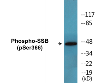 Western blot analysis of extracts from 293 cells, using SSB (Phospho-Ser366) Antibody.