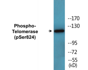 Western blot analysis of extracts from COLO205 cells, using Telomerase (Phospho-Ser824) Antibody.