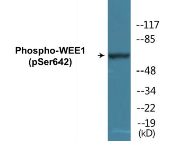 Western blot analysis of extracts from 293 cells treated with etoposide 25uM 60', using WEE1 (Phospho-Ser642) Antibody.