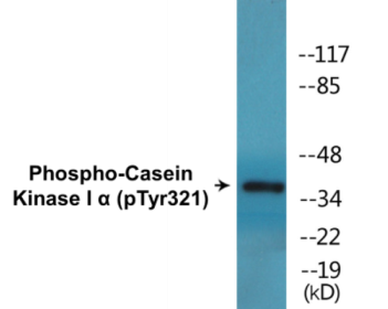 Western blot analysis of extracts from HuvEc cells, using Casein Kinase I alpha (Phospho-Tyr321) Antibody.