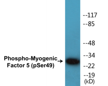 Western blot analysis of extracts from HeLa cells, using Myogenic Factor 5 (Phospho-Ser49) Antibody.