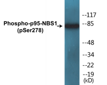 Western blot analysis of extracts from HuvEc cells treated with Forskolin 40nM 30', using Nibrin (Phospho-Ser278) Antibody.