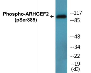 Western blot analysis of extracts from HeLa cells treated with TSA 400nM 24H and Jurkat cells treated with forskolin 40nM 30', using Rho/Rac Guanine Nucleotide Exchange Factor 2 (Phospho-Ser885) Antibody.