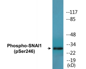 Western blot analysis of extracts from HT29 cells, using SNAI1 (Phospho-Ser246) Antibody.