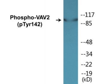 Western blot analysis of extracts from HeLa cells and K562 cells treated with TNF 20ng/ml 30', using VAV2 (Phospho-Tyr142) Antibody.