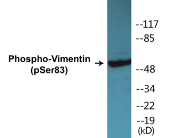 Western blot analysis of extracts from 293 cells treated with paclitaxel 1uM 24h, using Vimentin (Phospho-Ser83) Antibody.