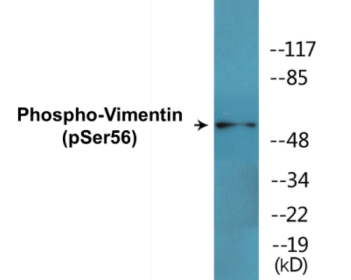 Western blot analysis of extracts from A549 cells treated with Nocodazole 1ug/ml 16h, using Vimentin (Phospho-Ser56) Antibody.
