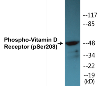 Western blot analysis of extracts from HT29 cells treated with heat shock, using Vitamin D Receptor (Phospho-Ser208) Antibody.