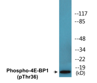 Western blot analysis of extracts from MDA-MB-435 cells treated with EGF 200ng/ml 30', using 4E-BP1 (Phospho-Thr36) Antibody.