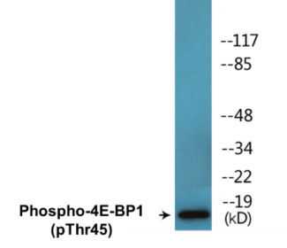 Western blot analysis of extracts from MDA-MB-435 cells treated with EGF 200ng/ml 5', using 4E-BP1 (Phospho-Thr45) Antibody.