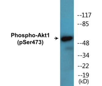 Western blot analysis of extracts from HeLa cells treated with heat shock, using Akt (Phospho-Ser473) Antibody.