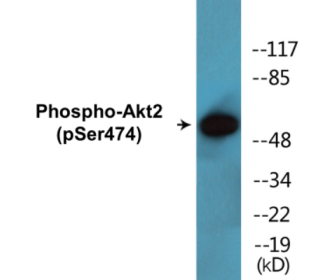 Western blot analysis of extracts from 293 cells treated with EGF 200ng/ml 30', using Akt2 (Phospho-Ser474) Antibody.