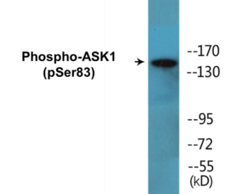 Western blot analysis of extracts from MDA-MB-435 cells treated with TNF-alpha, using ASK1 (Phospho-Ser83) Antibody.