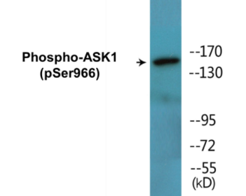Western blot analysis of extracts from 293 cells treated with TNF(20ng/ml)+calyculinA(50nM) 15', using ASK1 (Phospho-Ser966) Antibody.
