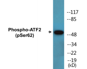 Western blot analysis of extracts from HeLa cells treated with TNF-alpha, using ATF2 (Phospho-Ser62 or 44) Antibody.