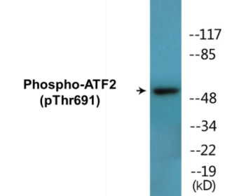 Western blot analysis of extracts from LOVO cells, using ATF2 (Phospho-Thr69 or 51) Antibody.