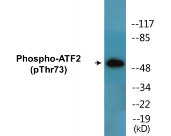 Western blot analysis of extracts from 293 cells treated with UV 15', using ATF2 (Phospho-Thr73 or 55) Antibody.