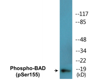 Western blot analysis of extracts from 293 cells treated with Forskolin, using BAD (Phospho-Ser155) Antibody.
