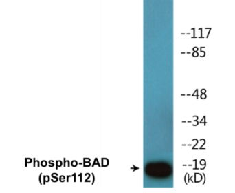 Western blot analysis of extracts from 293 cells treated with Forskolin, using BAD (Phospho-Ser112) Antibody.