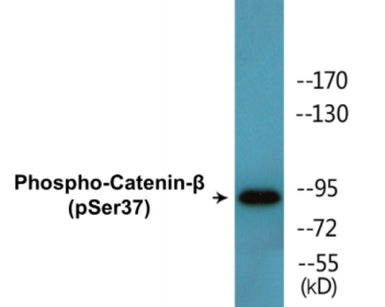 Western blot analysis of extracts from 293 cells, using Catenin-beta (Phospho-Ser37) Antibody.