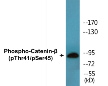 Western blot analysis of extracts from HepG2 cells, using Catenin-beta (Phospho-Thr41/Ser45) Antibody.