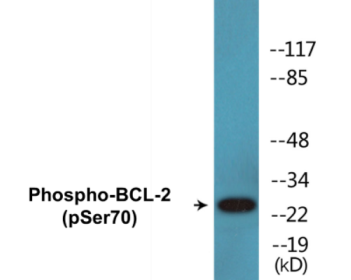 Western blot analysis of extracts from HeLa cells treated with LPS (40nM, 30mins), K562 cells treated with calyculin A (50ng/ml, 30mins) and COS-7 cells treated with H2O2 (1ng/ml, 15mins), using BCL-2 (Phospho-Ser70) Antibody.