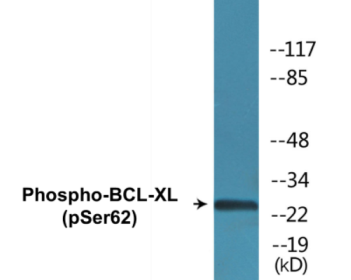 Western blot analysis of extracts from 293 cells treated with UV and MDA-MB-435 cells treated with UV, using BCL-XL (Phospho-Ser62) Antibody.