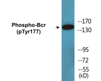 Western blot analysis of extracts from K562 cells, using Bcr (Phospho-Tyr177) Antibody.