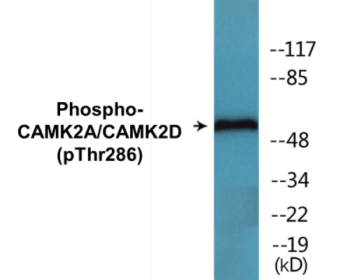 Western blot analysis of extracts from K562 cells, using CaMK2 (Phospho-Thr286) Antibody.