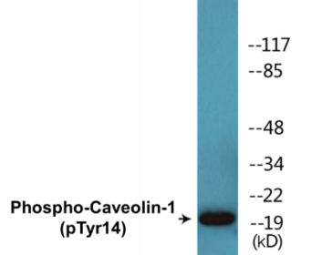 Western blot analysis of extracts from HuvEc cells treated with PMA 125ng/ml 30' and HeLa cells treated with LPS 100ng/ml 30', using Caveolin-1 (Phospho-Tyr14) Antibody.