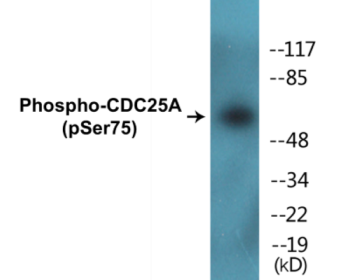 Western blot analysis of extracts from Jurkat cells treated with UV, using CDC25A (Phospho-Ser75) Antibody.