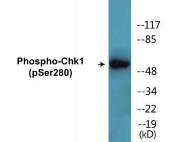 Western blot analysis of extracts from HeLa cells treated with Hu 2nM 24hours, using Chk1 (Phospho-Ser280) Antibody.