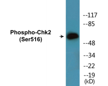Western blot analysis of extracts from HeLa cells treated with UV, using Chk2 (Phospho-Ser516) Antibody.