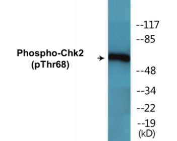 Western blot analysis of extracts from Jurkat cells treated with UV, using Chk2 (Phospho-Thr68) Antibody.