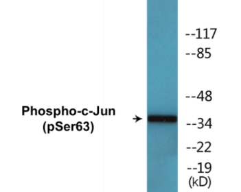 Western blot analysis of extracts from HeLa cells treated with UV, using c-Jun (Phospho-Ser63) Antibody.