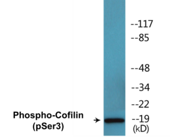 Western blot analysis of extracts from NIH-3T3 cells treated with paclitaxel 1uM 24hours, using Cofilin (Phospho-Ser3) Antibody.