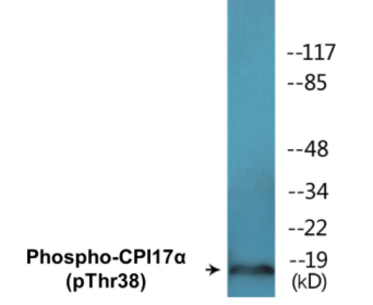 Western blot analysis of extracts from RAW264.7 cells, using CPI17 alpha (Phospho-Thr38) Antibody.